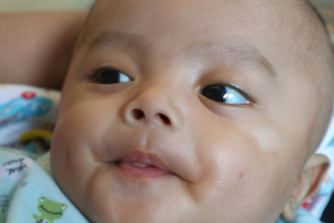 putih putih di wajah