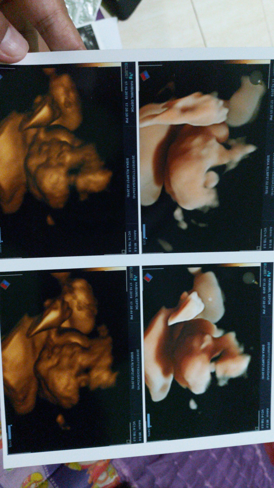 siska rahmadiya profile icon