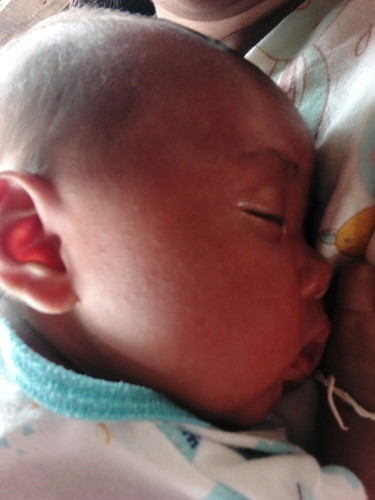 น้องมีตุมเล็กๆขึ้นที่หน้าปกติไหมคะ