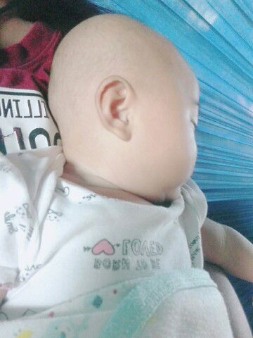 อย่างนี้เรียกว่าหัวแบนไหมคะ