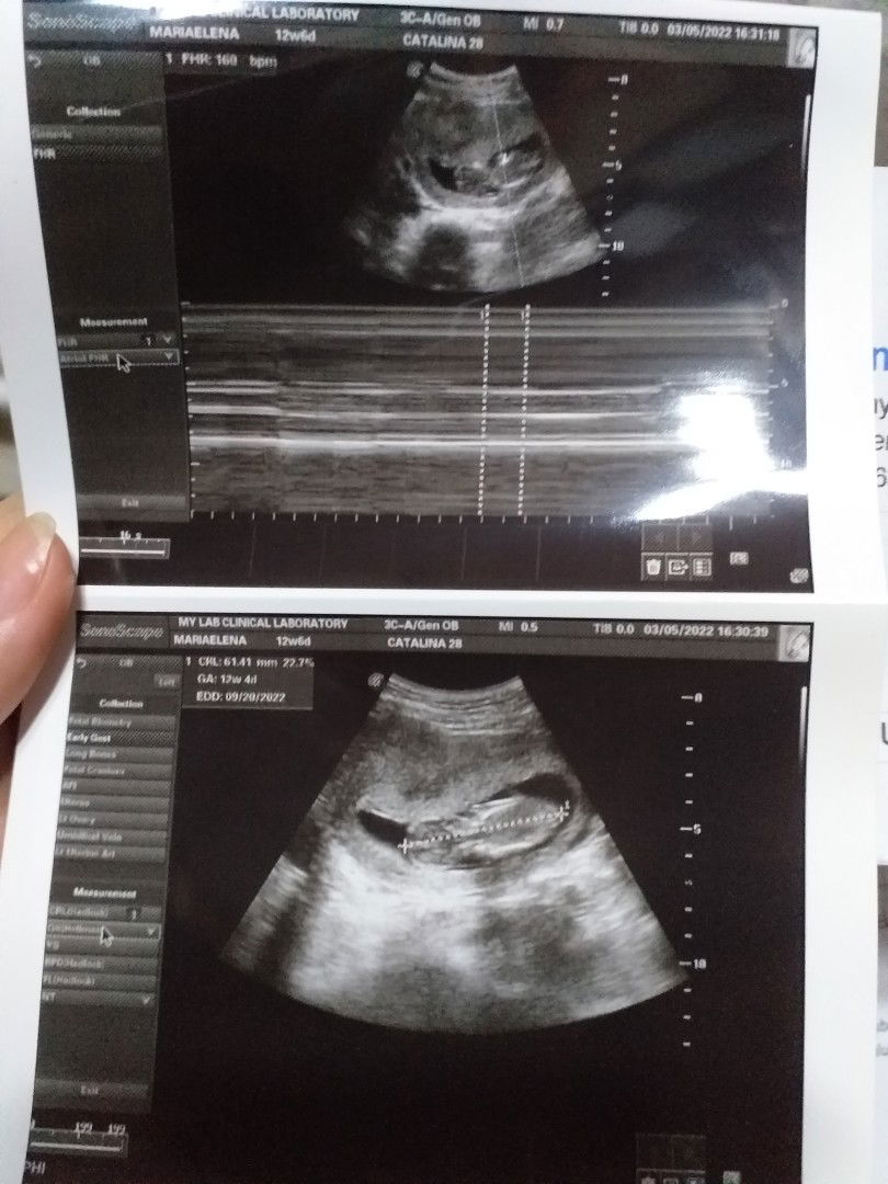 Chola Chua Catalina profile icon