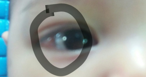 kelebihan selaput mata