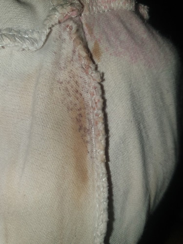 MENS / SPOTTING OR DISCHARGE?