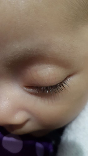bulu mata bayi dipotong