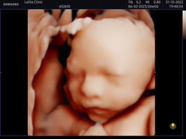 Wirunya Komwong profile icon