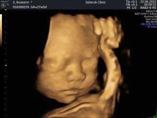 Nong mapord profile icon