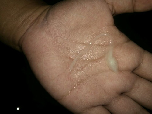 #ขอสอบถามแม่ๆหน่อยค่ะปวดท้องจี๊ดๆมีเมือกขุ่นๆ