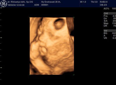 Enrawati profile icon