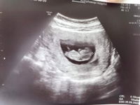 Apatsara profile icon