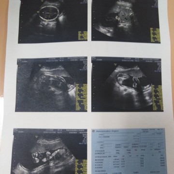 รูปเพศน้องอยุ่รูปไหนค่ะ