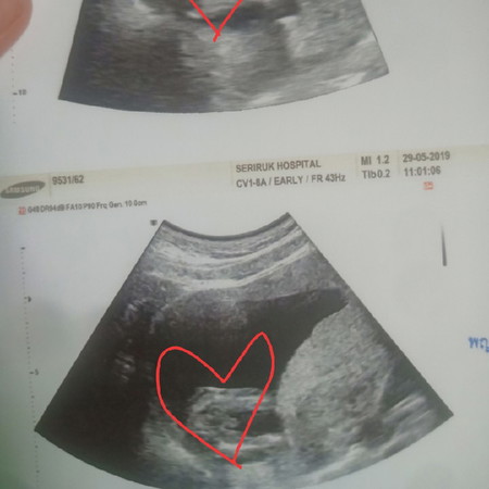 หายตื่นเต้นเลยคะ