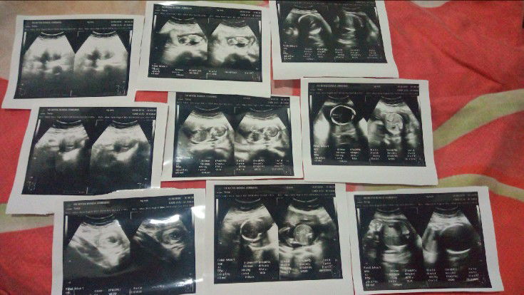 sekedar bercerita mudah2an bisa buat pelajaran buat kita semua