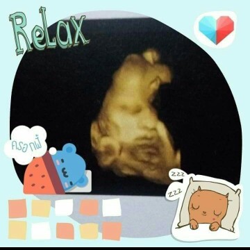 39w+2d รอ..