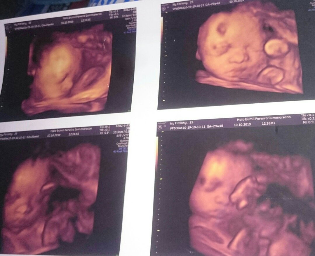 Fitri Yani profile icon