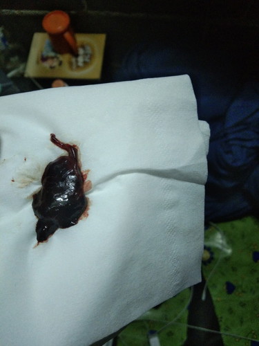 แม่ๆใครเป็นแบบนี้บ้างค่ะ