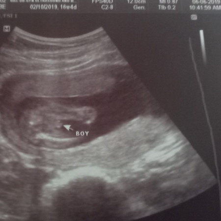 gender reveal at 16th week