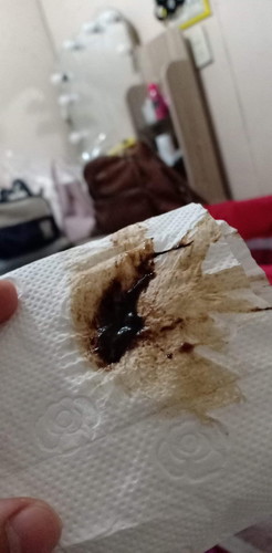 brown discharge / blood