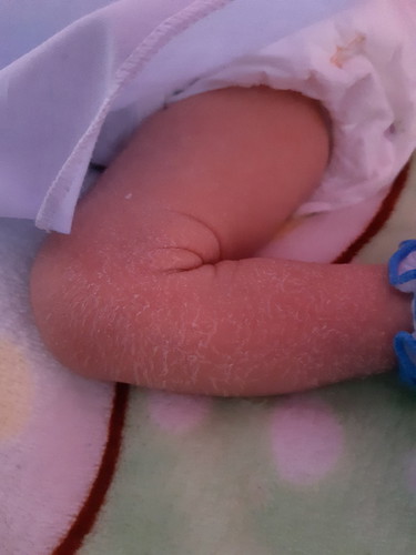 ปกติหรือไม่