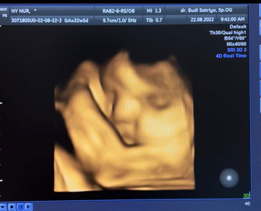 Nur Kholipah profile icon