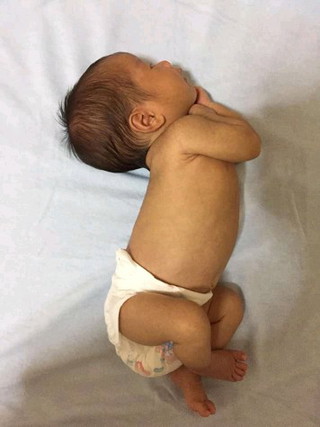 baby's head position