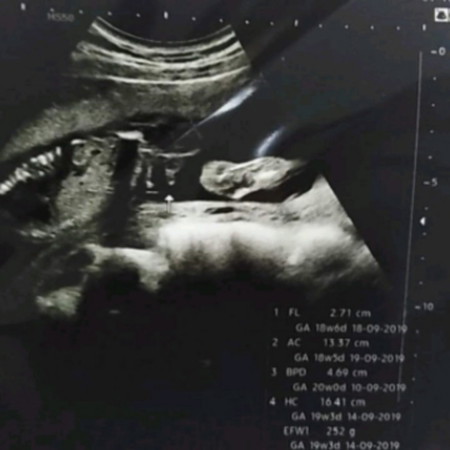 ช่วยดูหน่อยค่ะ ว่าเพศอะไร ขอบคุณค่ะ