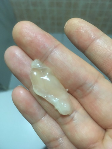 มีแบบนี้ออกมาต้องไปหาหมอไหมค่ะ