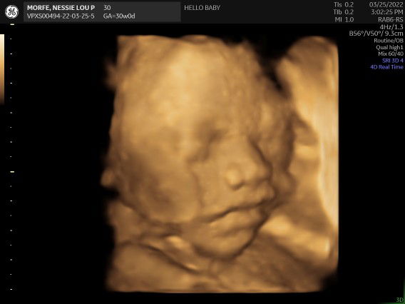 Lucas morfe profile icon