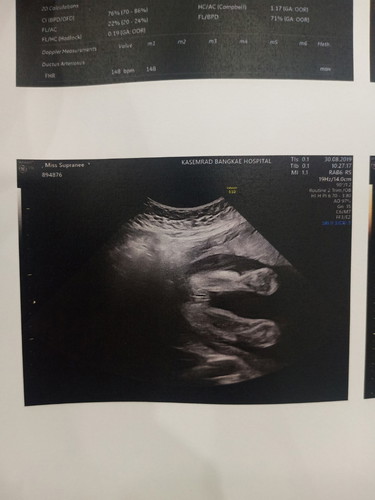 มาแล้วววลูกสาวของม่ามี๊?