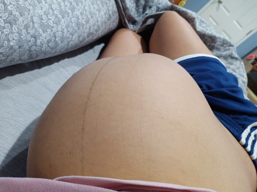 ไกล้คลอด 36week3วัน