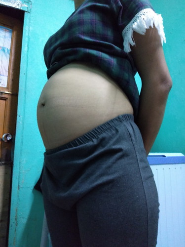 Baby ของฉัน