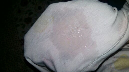 สอบถามเรื่องมูกใส่กับน้ำเดินหน่อยค่ะ