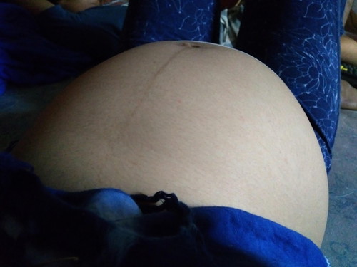 30 week แระจ้า