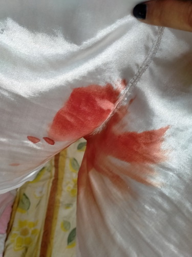 เลือดไหลมาตลอดตั้งแต่คลอดจนตอนนี้ 8 เดือน