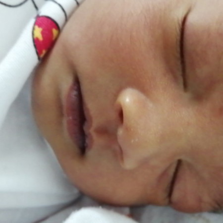แม่ๆค่ะน้องพึ่งได้11วันตาแฉะทังสองข้างเลยมีวิธีไหน รักษาบางค่ะ ลูกคนแรกค่ะ