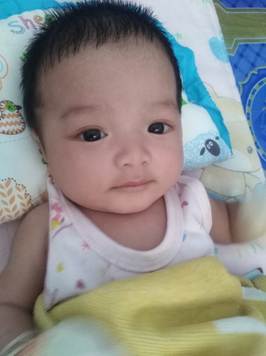 มีเลือดออกทางช่องคลอด