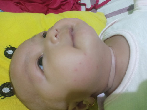 Kepala bayi 4 bulan sering mendongak ke atas