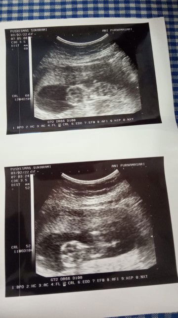 ani purnama sari profile icon