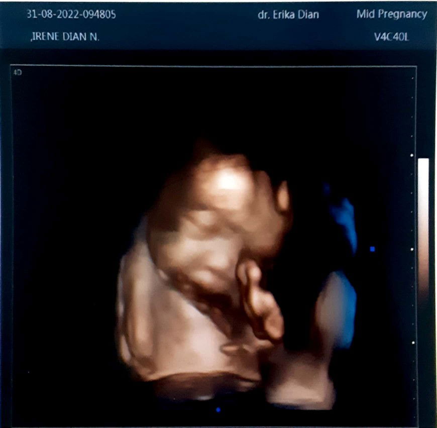 irene novina profile icon