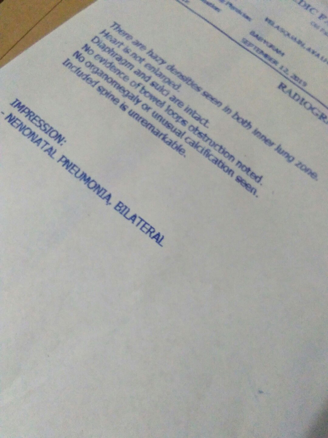 2weeks old baby girl-inuubo