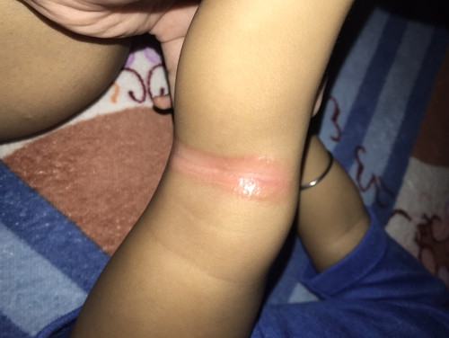 Kesehatan bayi