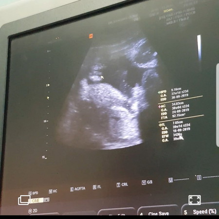 ลูกสาว