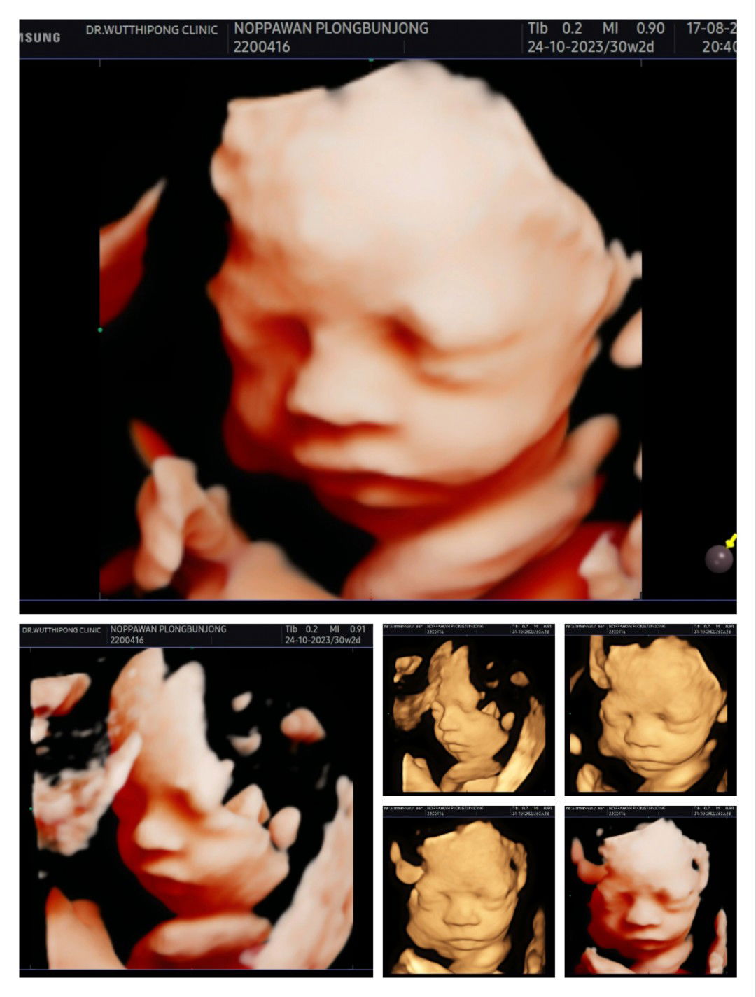 นพวรรณ ปล้องบรรจง profile icon