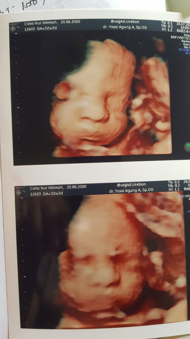 Ciskanur Ciska profile icon