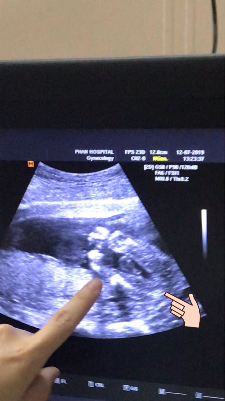 เพศลูกแบบนี้ ผญ รึป่าวคะ