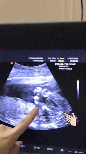 เพศลูกแบบนี้ ผญ รึป่าวคะ