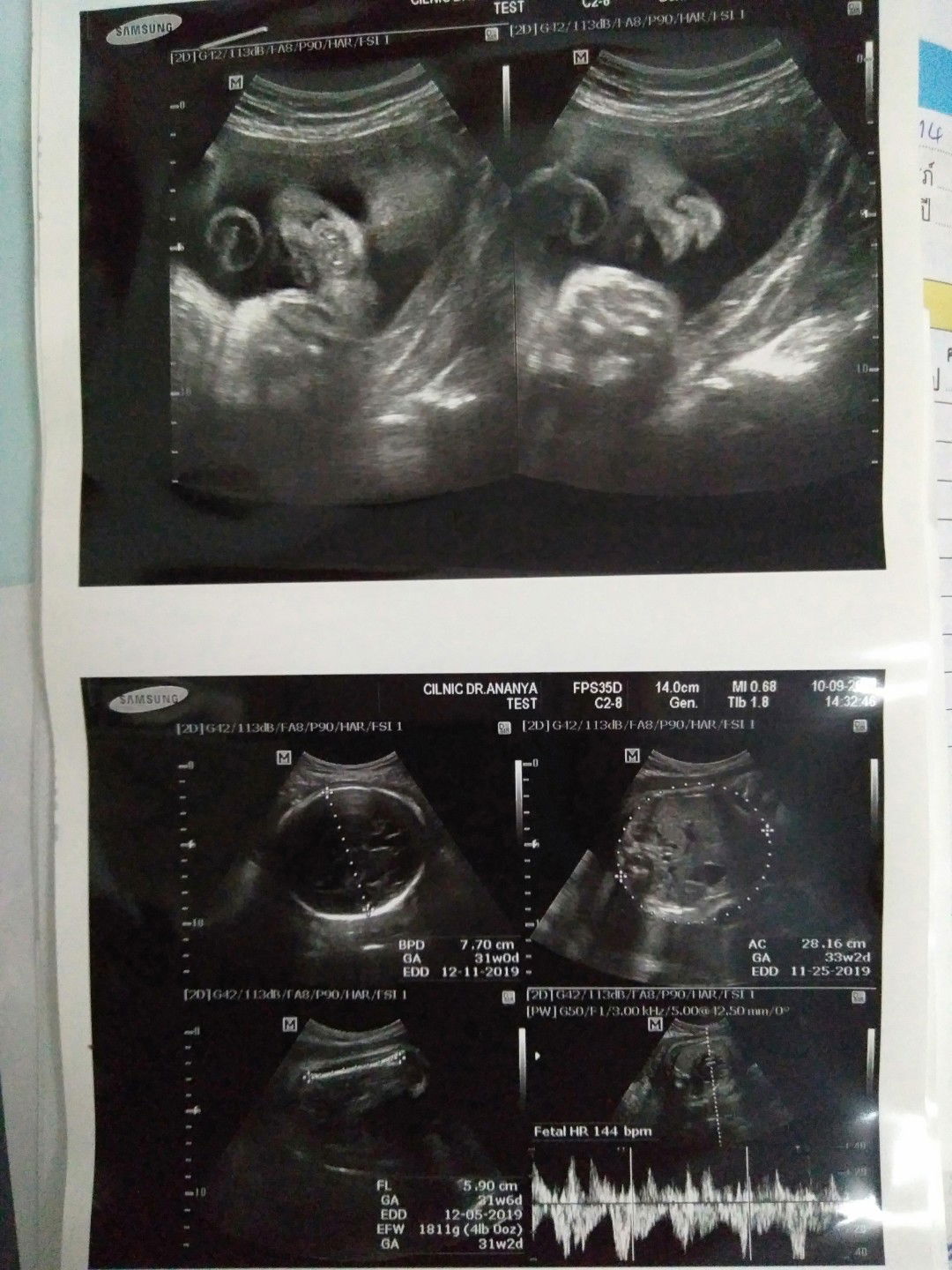 กำหนดผ่า