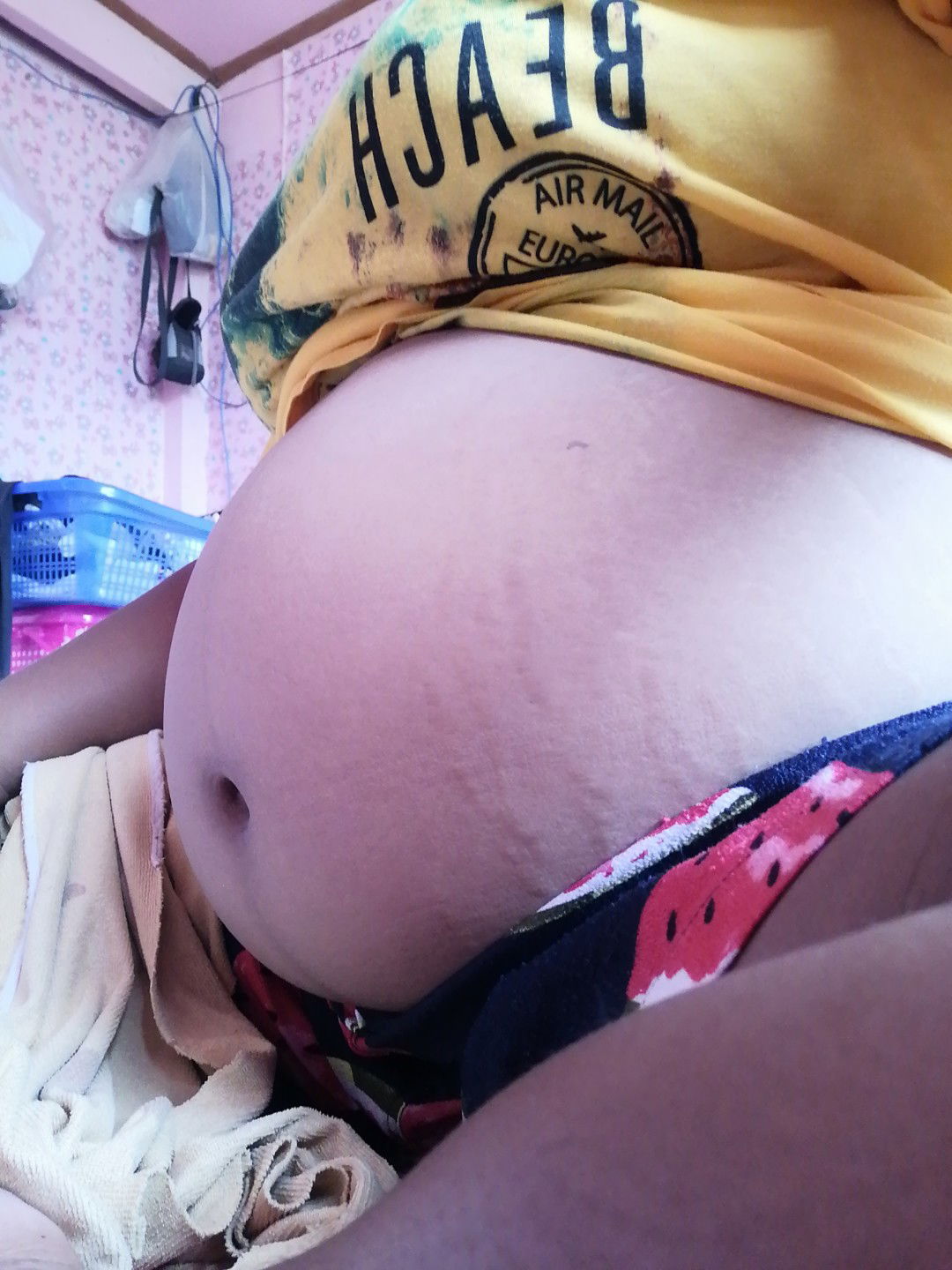 รอยแผนที่บนท้องของแม่​ ?