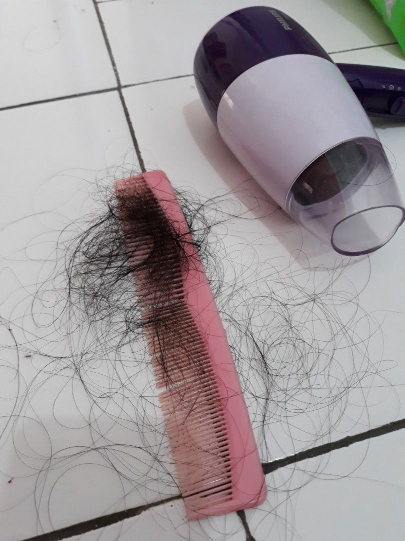 Rambut rontok parah pasca melahirkan