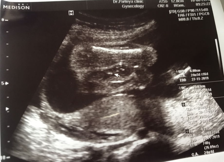 แม่ลูกชายสอง