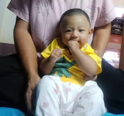 รอยนูนบนหน้าผากเด็ก 4เดือน